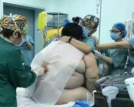 醫生替孕婦剖腹後，手伸進她的體內時竟「摸不到孩子」！最後醫生只好…