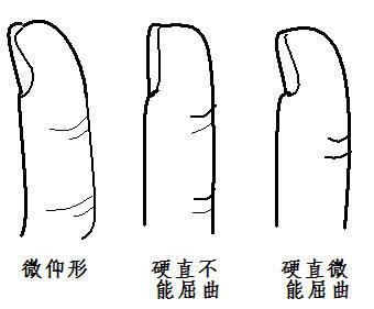 你身邊有「大拇指與手掌可成90度」的人嗎?以後看到千萬別跟他們做朋友呀!