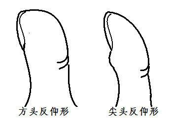 你身邊有「大拇指與手掌可成90度」的人嗎?以後看到千萬別跟他們做朋友呀!