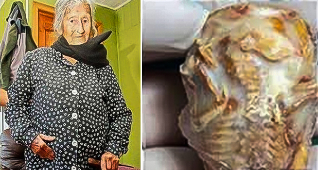 92歲阿嬤「懷孕」了?沒想到胎兒竟在肚子裡待超過60年!阿嬤:「這輩子最大的遺憾之一」