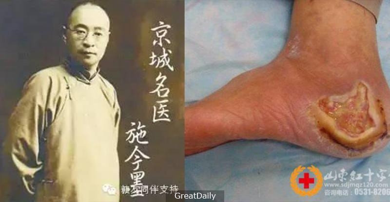 超強!中國四大名醫的糖尿病驗方,沒有一個病患高血糖是救不回來的,不想吃藥一輩子的一定要看一看!
