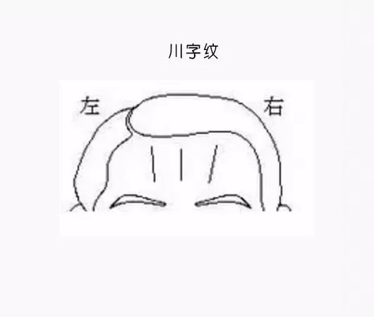 男克妻,女克夫……就因額頭這道紋?