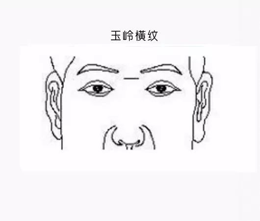 男克妻,女克夫……就因額頭這道紋?