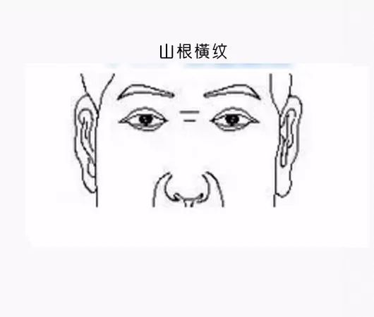 男克妻,女克夫……就因額頭這道紋?