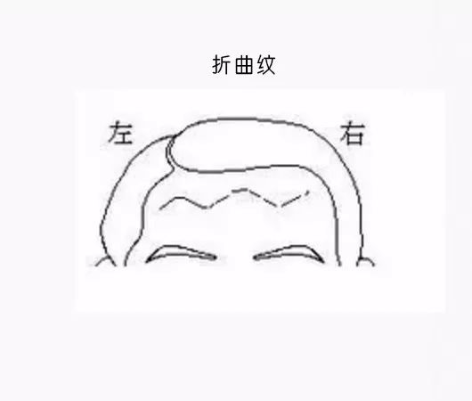 男克妻,女克夫……就因額頭這道紋?