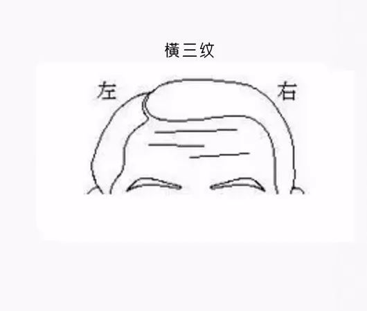 男克妻,女克夫……就因額頭這道紋?