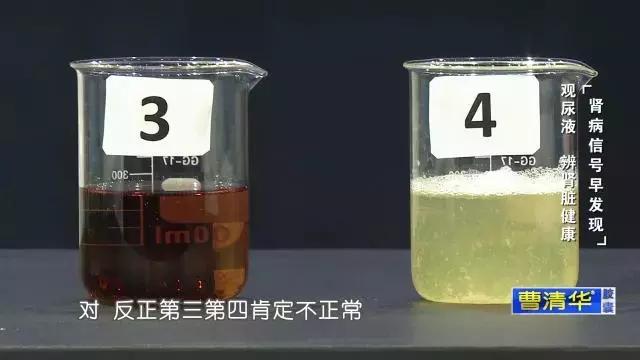 再這樣喝水,你將親手「毀掉」自己的腎!