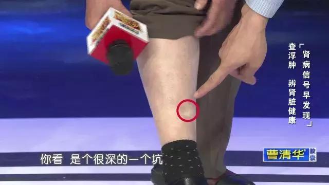 再這樣喝水,你將親手「毀掉」自己的腎!