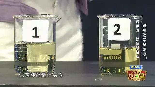 再這樣喝水,你將親手「毀掉」自己的腎!