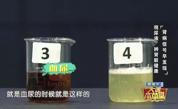 再這樣喝水,你將親手「毀掉」自己的腎!
