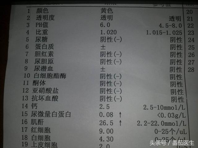排尿很黃,異味很大,是身體的什麼信號嗎?