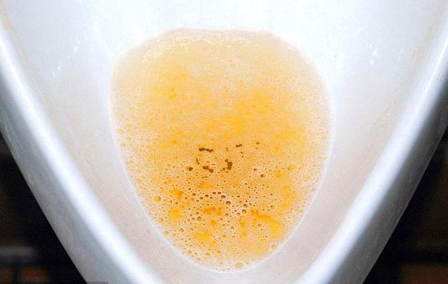 排尿很黃,異味很大,是身體的什麼信號嗎?