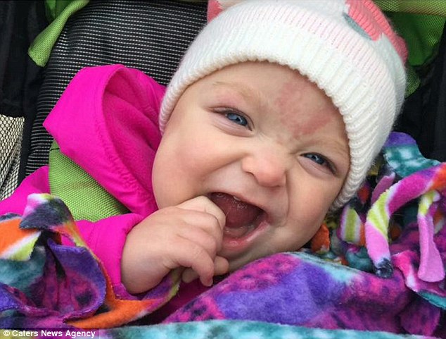 女嬰一出生「舌頭比嘴巴大2倍」差點噎死，醫生一刀割開...她「首次露笑容」現在可愛到炸！