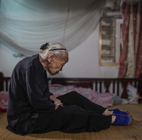 她從「5歲開始裹小腳」到現在100年過去了「從沒看過」自己雙腳,沒想到打開的瞬間「大家都嚇死了」