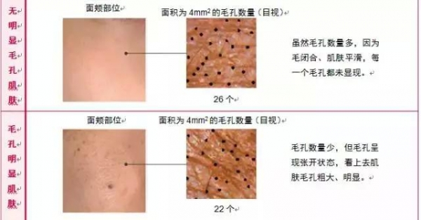 「7天」改善毛孔粗大問大!不改善你會老得更快!