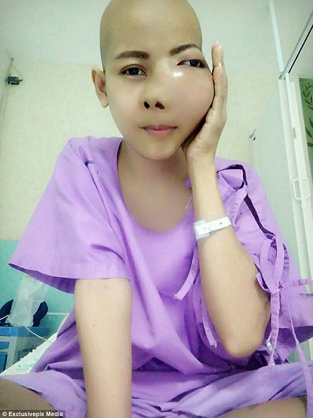 28歲正妹單親媽媽「從牙痛變癌症」震驚全球!近日竟惡化到「連牙齒都爆出來」她哭喊:「我還不想死....」