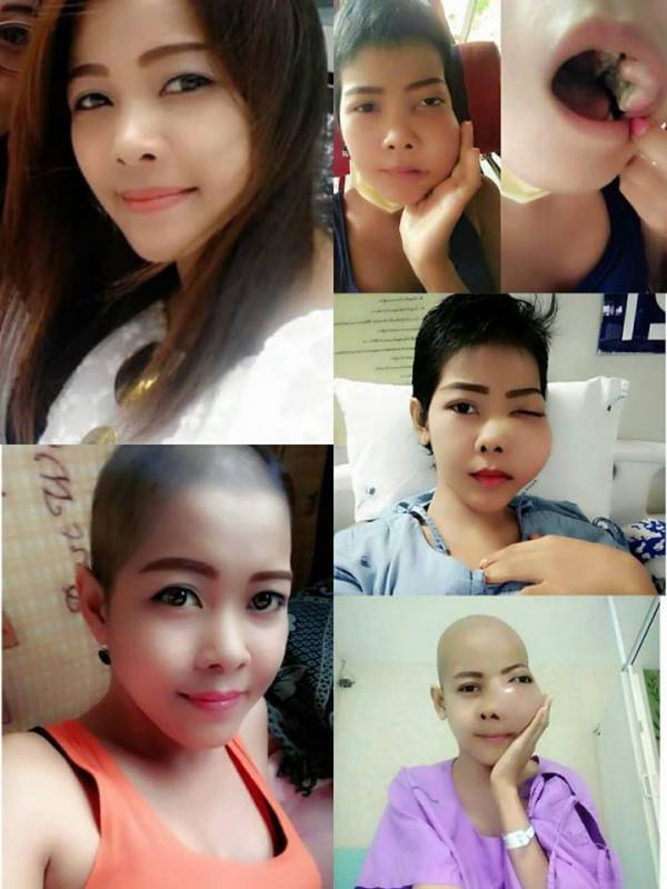 28歲正妹單親媽媽「從牙痛變癌症」震驚全球!近日竟惡化到「連牙齒都爆出來」她哭喊:「我還不想死....」