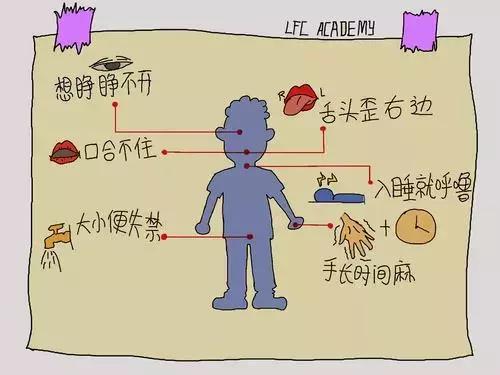 這個症狀是腦中風的前兆,5個動作10秒自測,防患於未然