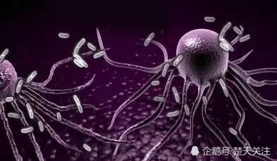 記者遭遇「冰箱殺手」生命垂危!你知道怎麼防範這種怪病嗎?