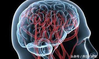 10個信號一出現,小心腦血管要「崩潰」,養血管謹記「五多四少」