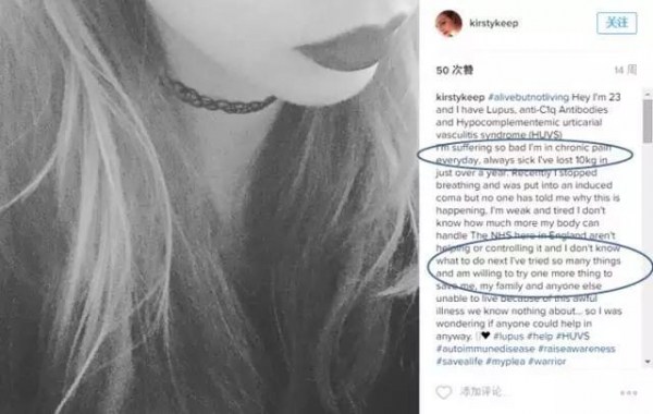 恐怖!被這種蟲咬到包你生不如死!23歲女子被咬,受不了要求安樂死…..案例太多了,一定要注意!