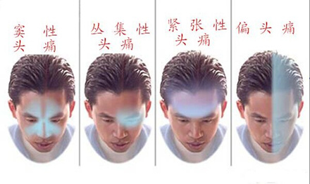 警惕危險信號~頭痛竟有10多種?頭痛是如腦出血、腦膜炎等嚴重疾病的徵兆和表現,應該及時就診。