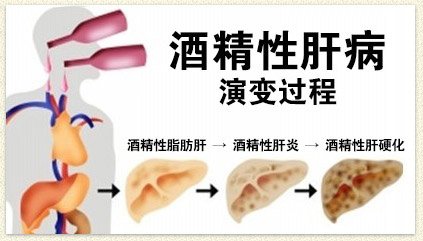 可怕的肝硬化上了你的身?教你一個方法,把肝臟養的「軟」回來