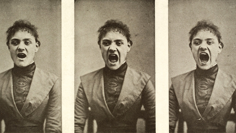 19世紀女性「一有性慾」就視為歇斯底裏症！她們「子宮整個被摘掉」關牢獄隔離，超詭異「治療病患照片」曝光...