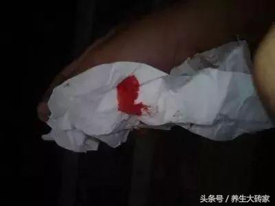 醫生提醒:有這四個症狀,可能是腸癌早期,3件事,再難也要堅持