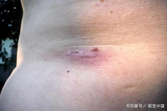 有這10種特征的最易得癌,看看你和家人有沒有?