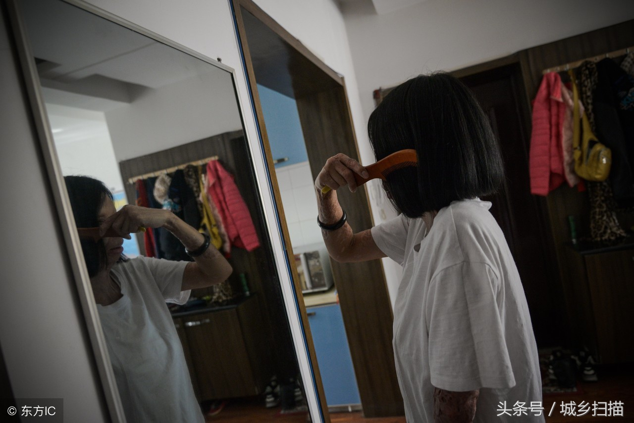 慘遭前男友潑硫酸毀容,32歲漂亮女子變「怪物」,開網絡直播賺錢-雪花新聞