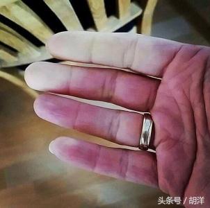 不用醫療設備檢查,只看手,我們能看出哪些疾病的端倪