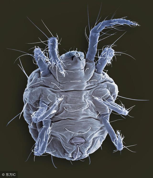 蟎虫一种微小的卫生,肉眼是没法看见的,需要放在显微镜下才能看到.
