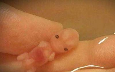 女子流產把2個月寶寶保存起來，網友：她有多瘋狂母愛就有多偉大