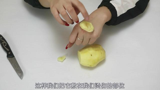 土豆片貼在眼睛上,眼袋皺紋慢慢就消失了,很管用