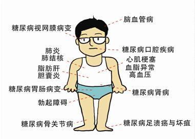 當心!一人糖尿病全家都易得,預防幹貨在這裡