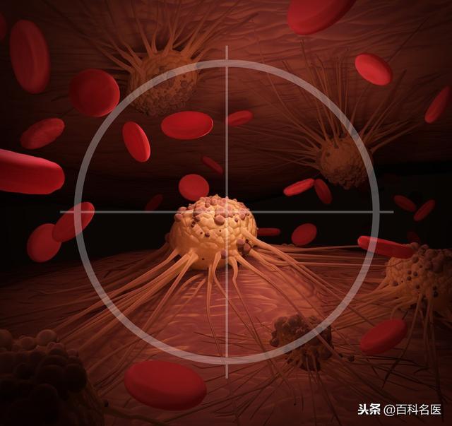 6大因素導致淋巴瘤發病率越來越高,你中了幾個?
