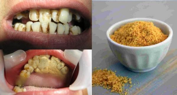 「黄牙垢」又臭又丑!这些食物竟然能有效清洁牙垢，要有美齿先每天吃他们再说! EZP9 生活网