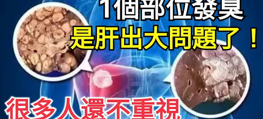 1個部位發臭,是肝出大問題了,醫生看了都怕怕,很多人還不重視!