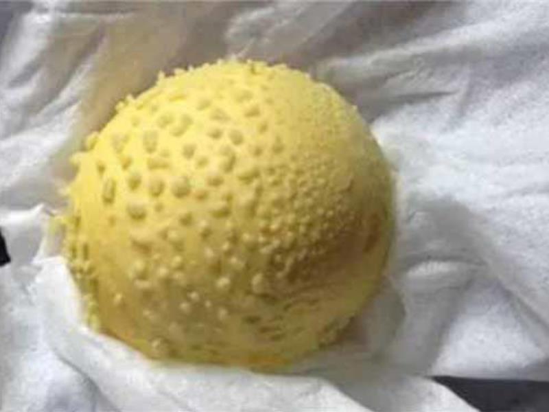 晚上睡觉小腿突然抽筋咋回事?如何预防? EZ生