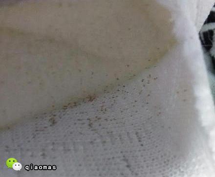 寶寶反覆長蕁麻疹,直到媽媽翻開床墊,密集恐懼症慎點!