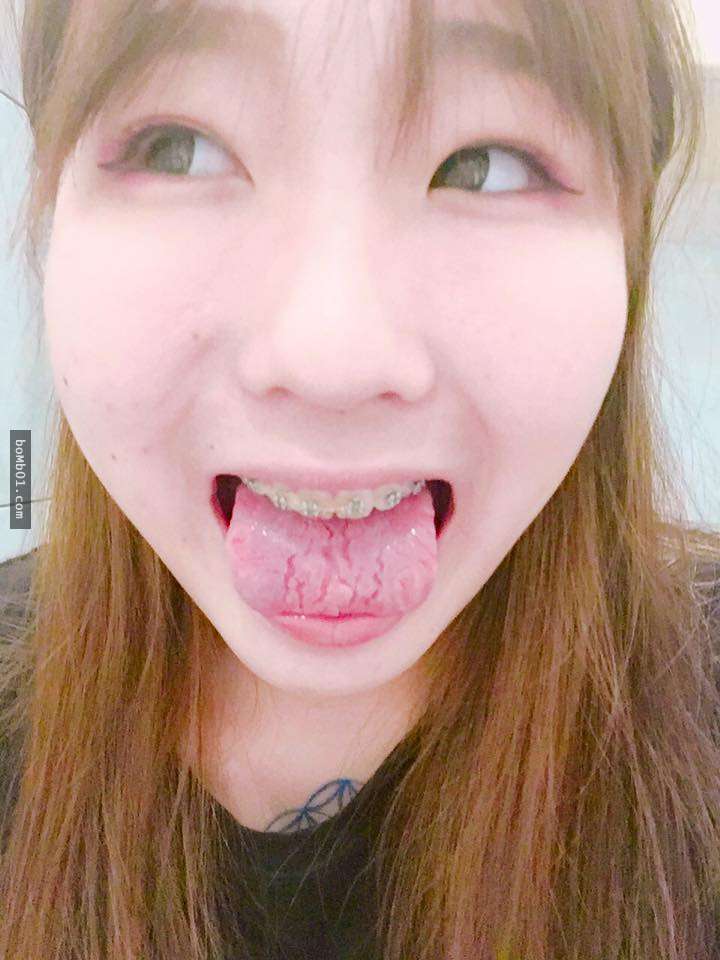 有许多网友表示,自己也是从小舌头就这样,但许多人因为改变作息,补充