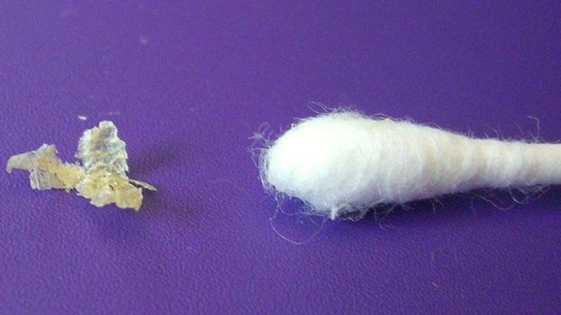 「耳屎」需要挖吗?没想到答案竟然是这样.太震