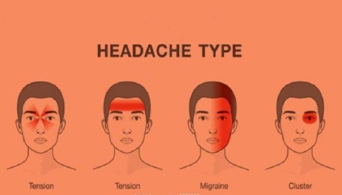 长期「偏头痛」者注意!5种不同的疼痛部位代表身体不