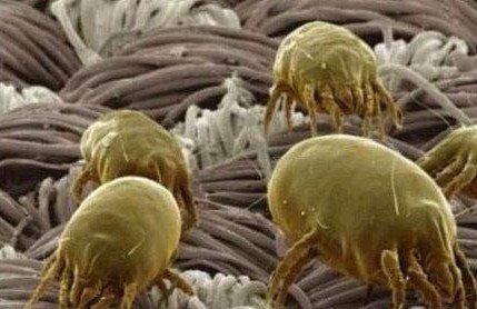 全家人也被尘螨过敏所苦吗?告诉您如何有效杀