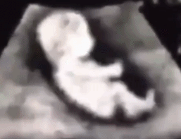 14782298277747.gif