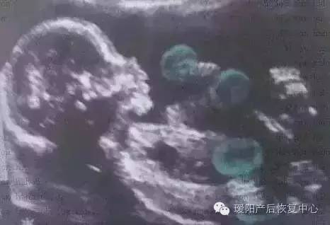 14782298292580.jpeg