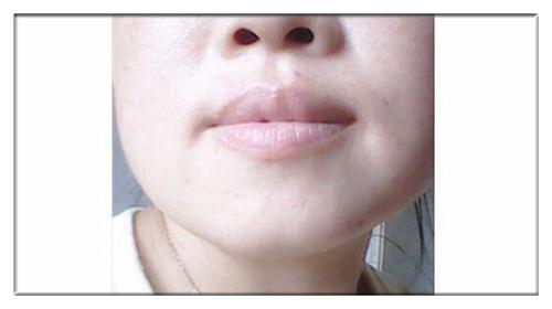 老中医是怎么通过「唇色」诊病的?秘密就在这