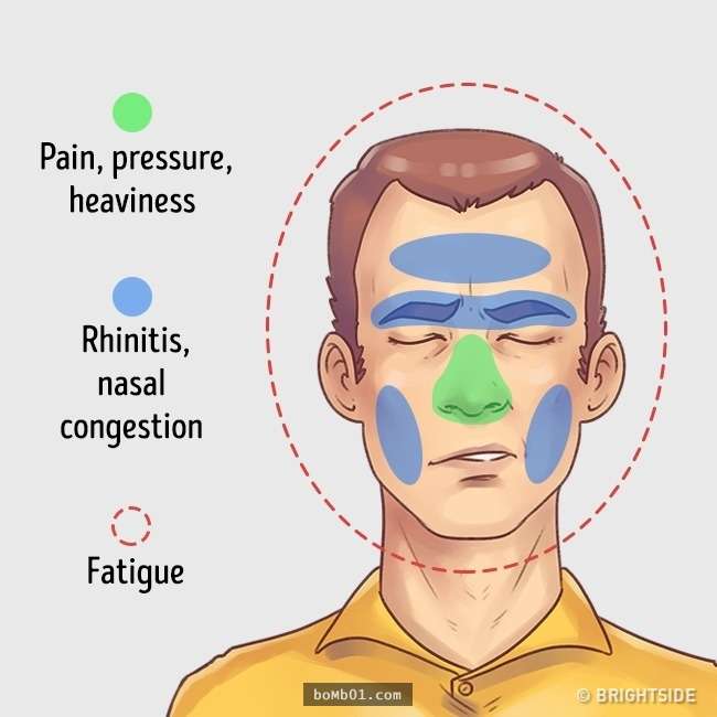 這就是5大「最常見頭痛類型」及正確止痛方法，經常頭痛的人一定要搞清楚自己是哪一種！