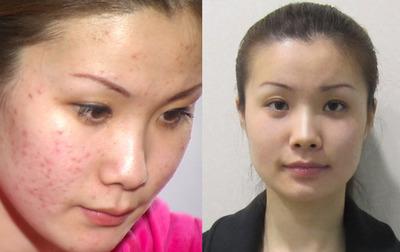 臉上持續出現這個,可別以為是自己變年輕了,而是該查血糖了